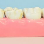 8 Natural Ways to Fight Back Against Tooth Plaque