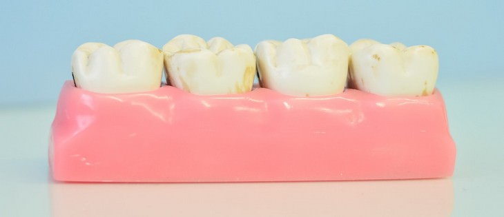 8 Natural Ways to Fight Back Against Tooth Plaque