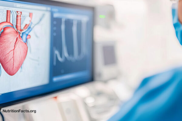 Cardiologists, Heart Stents, and Upcoding 
