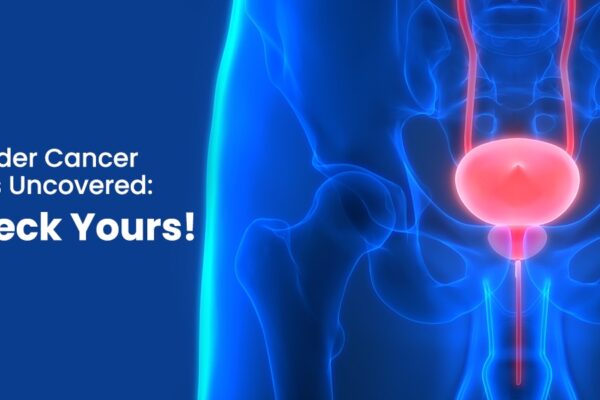 Is Your Lifestyle Increasing Your Bladder Cancer Risk? Find Out Now