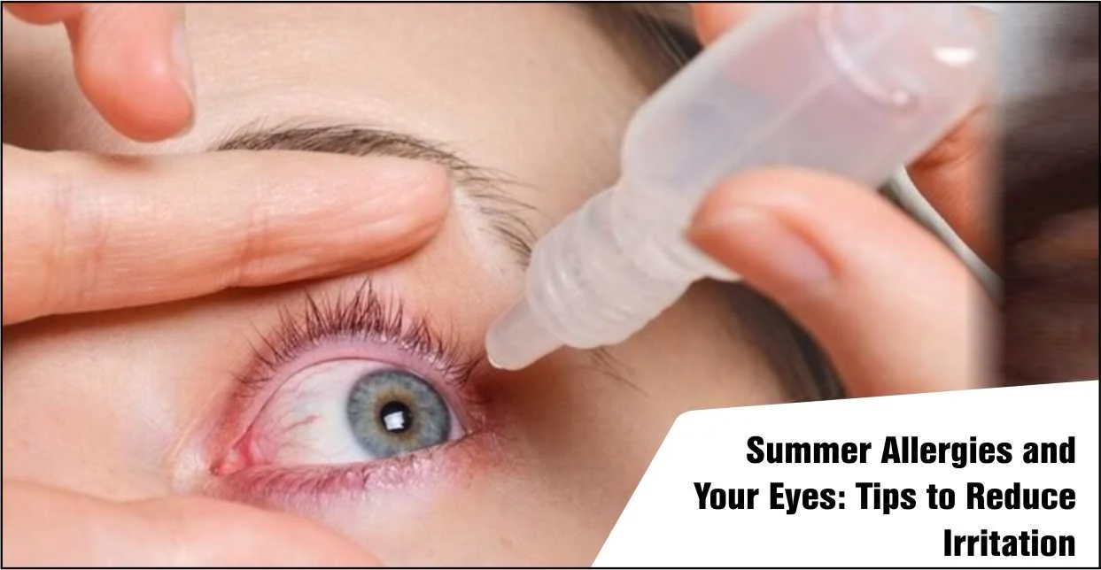 Summer Allergies And Your Eyes: Tips To Reduce Irritation