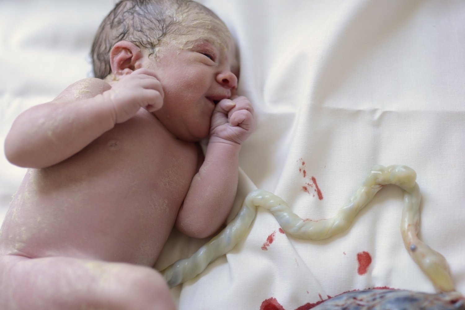 Why Delayed Cord Clamping Matters — Oh Baby