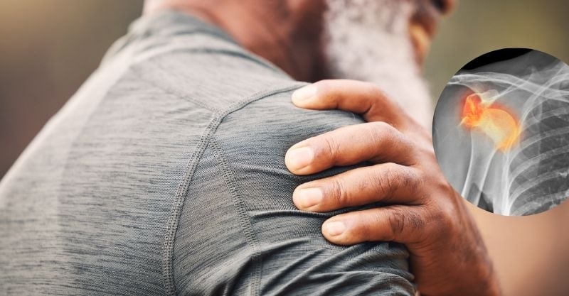 3 Shoulder Exercises to Stop Stiffness and Conquer Frozen Shoulder