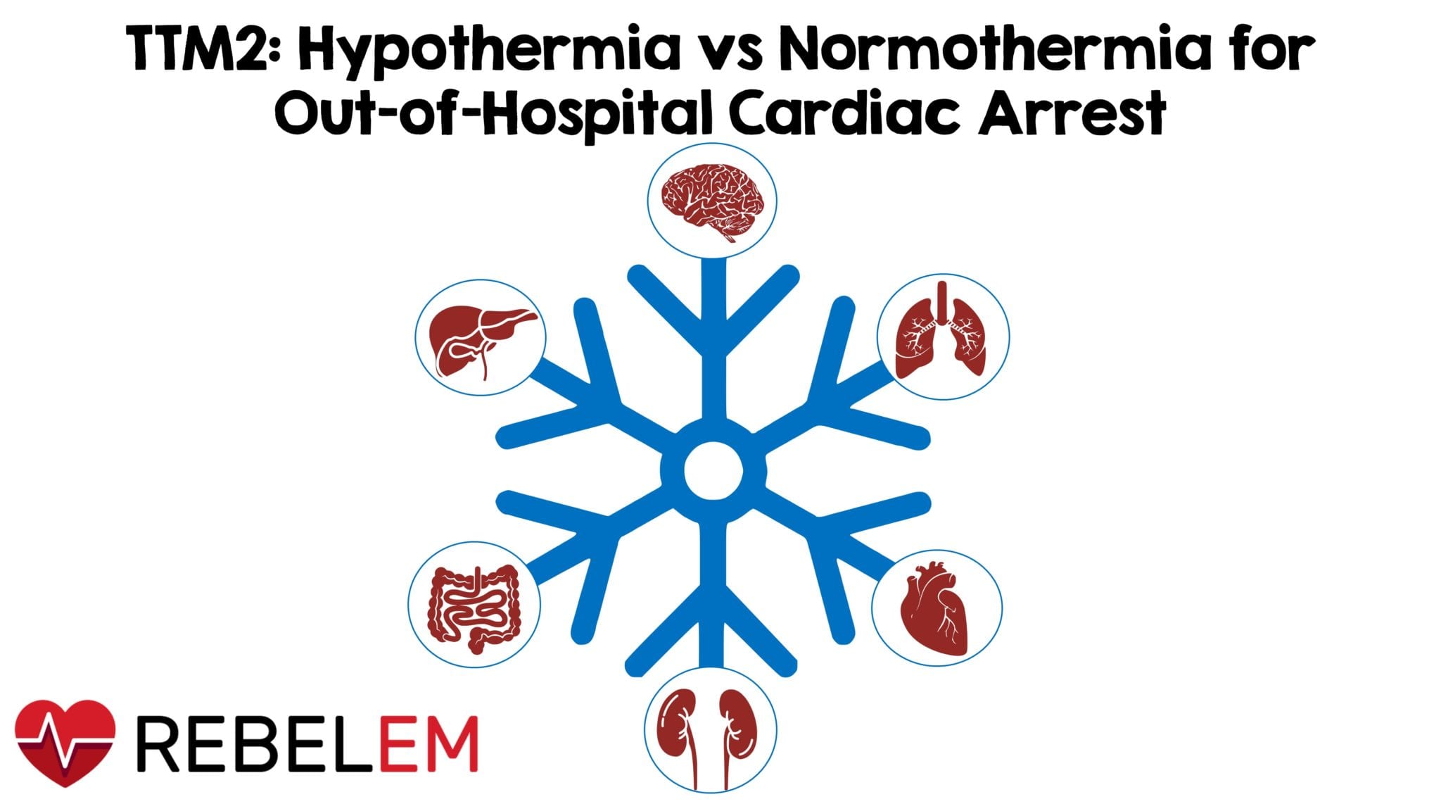 TTM2: Hypothermia vs Normothermia for Out-of-Hospital Cardiac Arrest – REBEL EM
