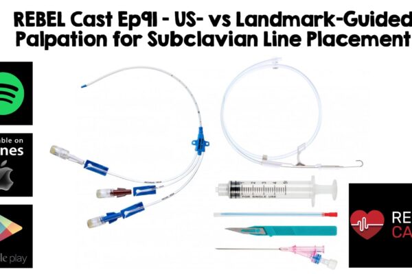 REBEL Cast Ep91: Static Ultrasound vs Landmark Placement of Subclavian Central Lines – REBEL EM