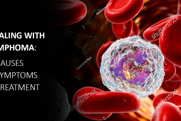 Dealing with Lymphoma: Causes, Symptoms and Treatment Dealing with Lymphoma: Causes, Symptoms and Treatment