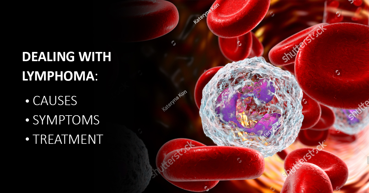 Dealing with Lymphoma: Causes, Symptoms and Treatment