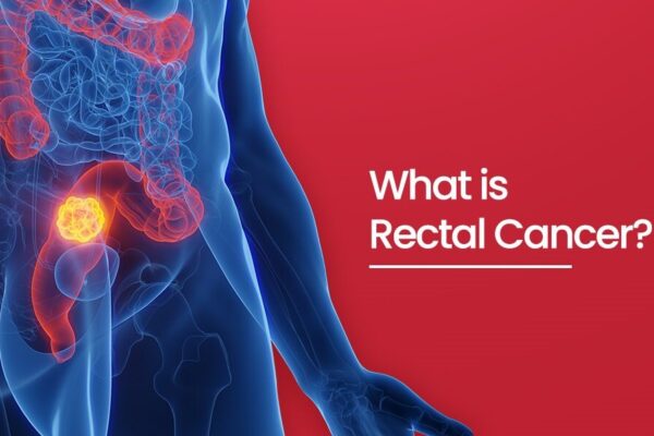 Symptoms, Causes & Treatment Guide