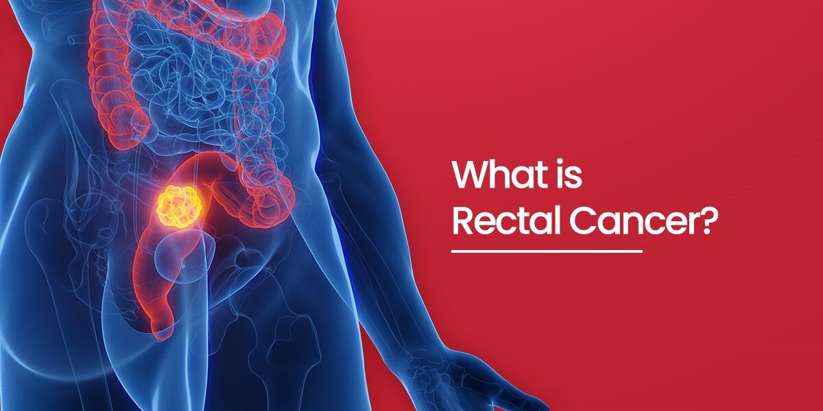 Symptoms, Causes & Treatment Guide