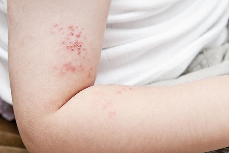 What Are the Serious Side Effects of These Common Drugs?