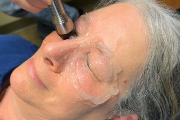 Elevate Your Look & Comfort with Aesthetic Treatments