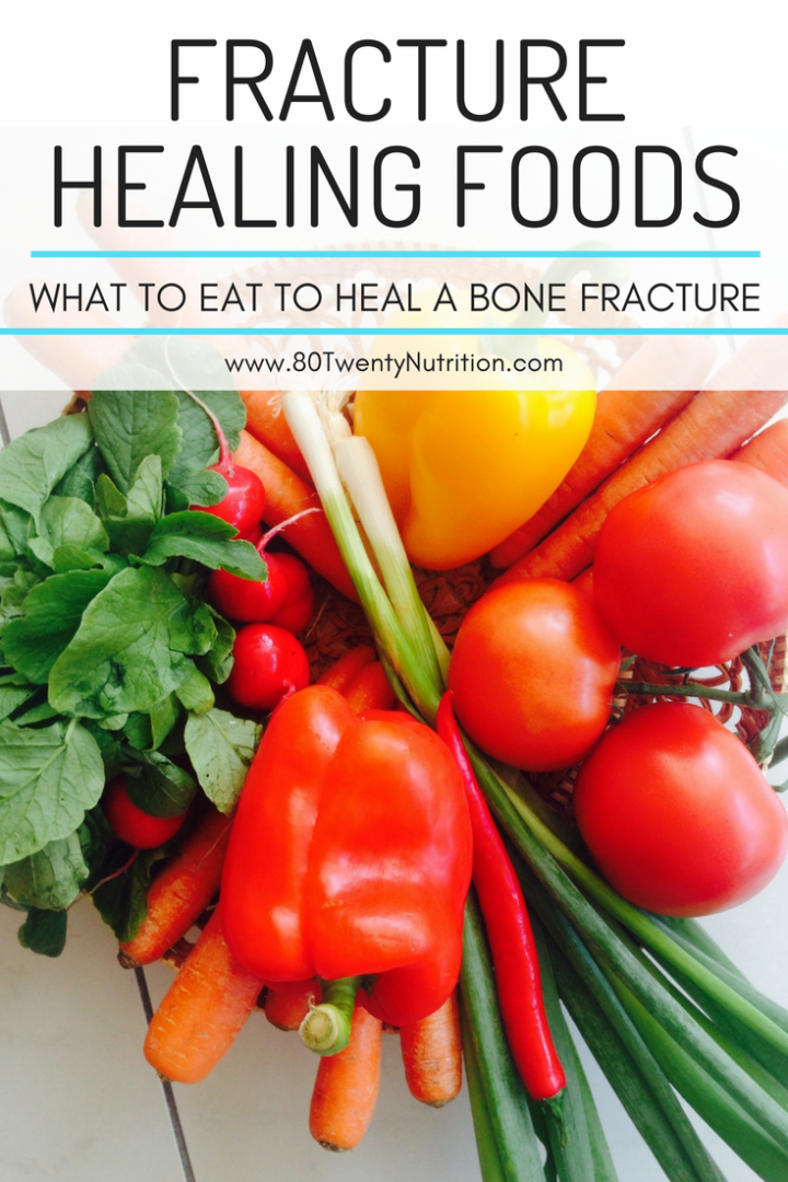 Fracture Healing Foods – 80 Twenty Nutrition