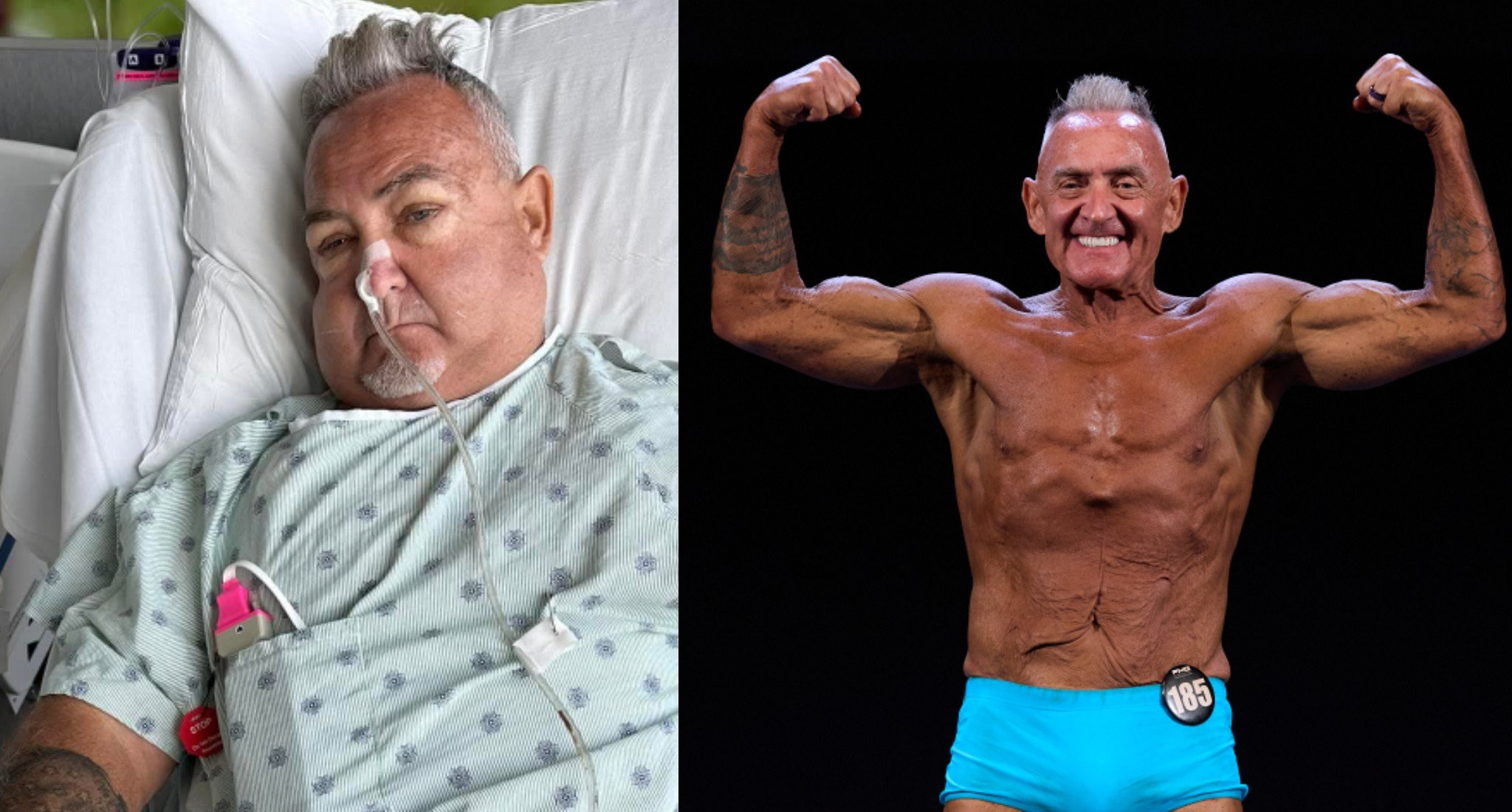 From Hospital Bed and Obesity to Stage-Ready