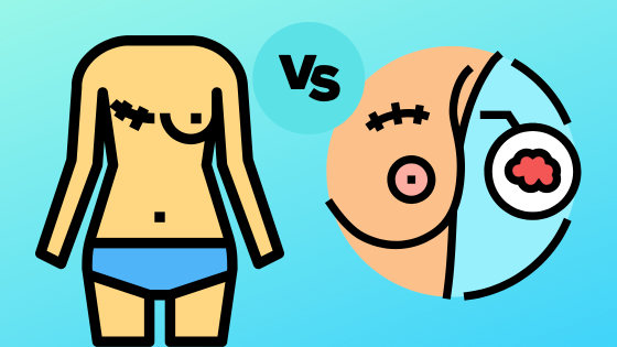 Lumpectomy vs. Mastectomy: Why Physical Therapy Matters for Recovery