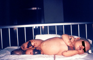 Reasons To Vaccinate Your Child #7