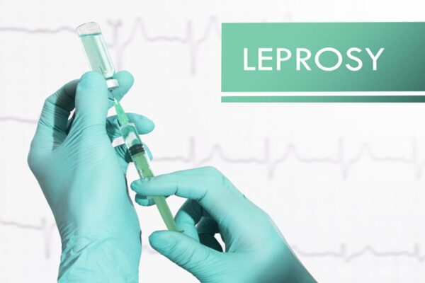 After 13 years, Maharashtra hikes grants for Leprosy Hospitals
