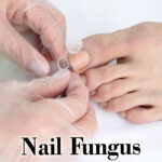 Efinaconazole 10% Proven Safe and Effective for Toenail Fungus in Older Adults: Study