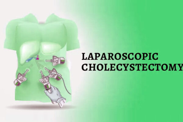 Laparoscopic Cholecystectomy Safe and Feasible in Pregnancy: Study Laparoscopic Cholecystectomy Safe and Feasible in Pregnancy: Study