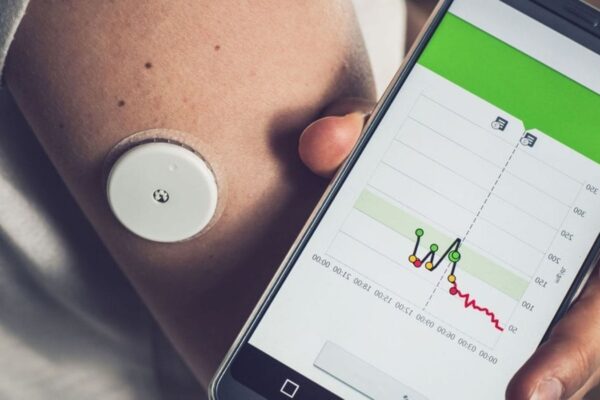 CGM Metrics Strongly Predict 5-Year Mortality Risk in Diabetes, Study Shows