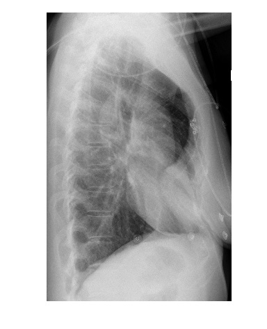 Imaging Case of the Week 503