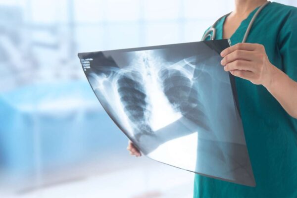 Nurse-Performed Lung Ultrasound Shows High Specificity for Pulmonary Congestion: Study