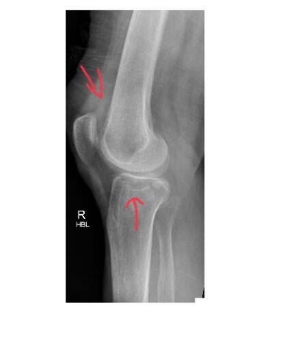 Imaging Case of the Week 497 Answer