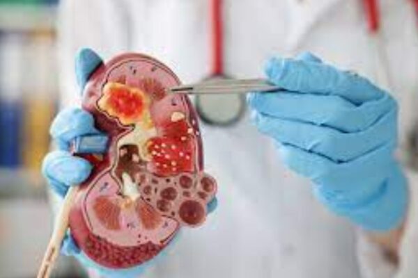 Ureteroscopy and Shockwave Lithotripsy exhibit Similar kidney stone Clearance: JAMA