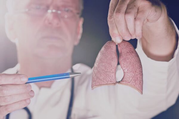 COPD patients with mucus plugs have increased risk of lung cancer: Study