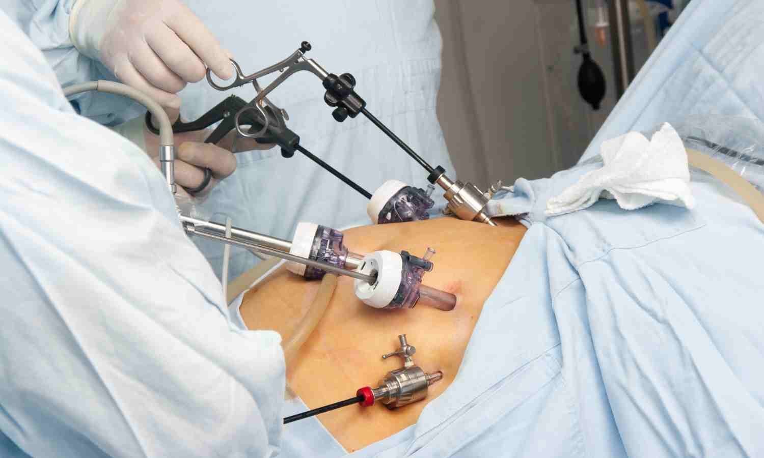 Study assessed Advanced Pain Relief Strategies After Gastric Resection