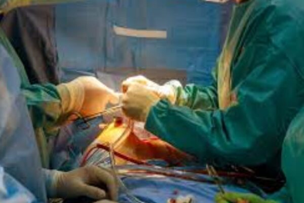Dapagliflozin reduced mortality risk in aortic stenosis patients undergoing TAVI: Study