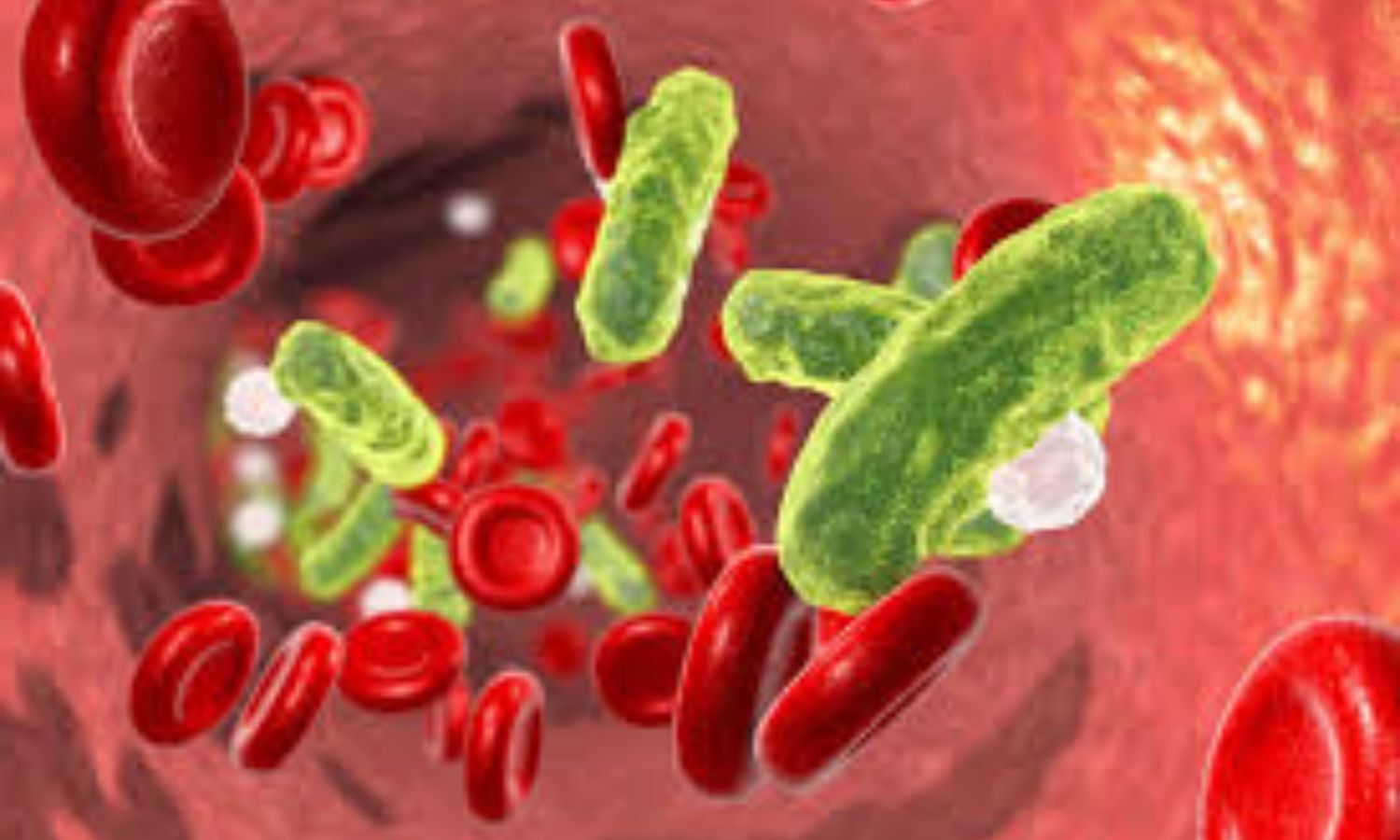 7-day antibiotic regimen good enough for tackling bacteremia and reducing length of hospitalization: Study
