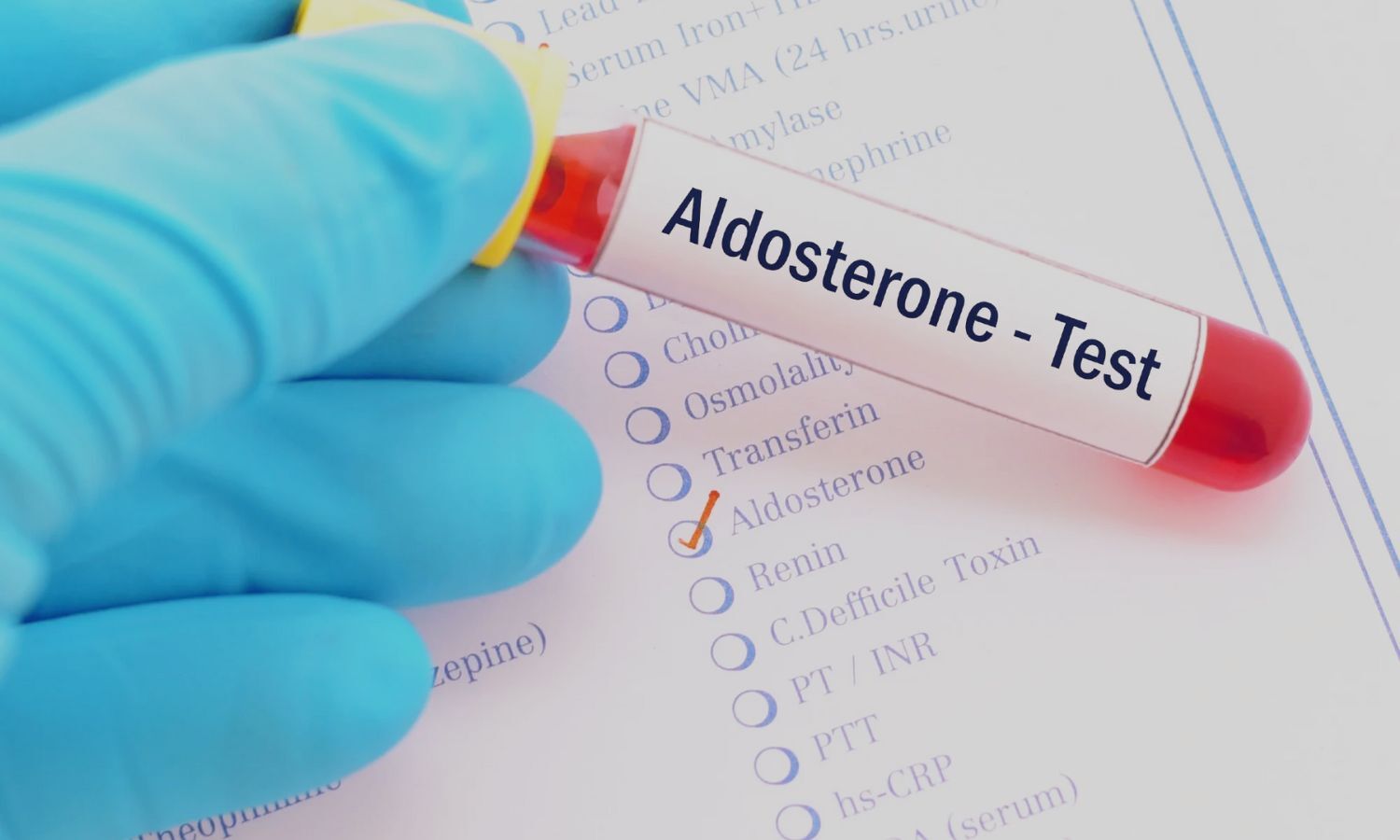 Subclinical Primary Aldosteronism Raises Risk of MACE Even With Normal BP, Suggests Study