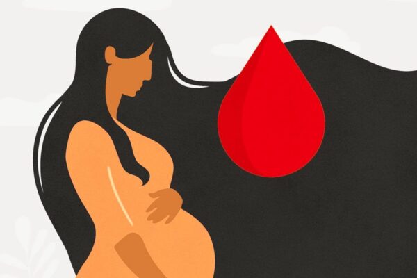 The Unseen Connection of Epidurals and Postpartum Hemorrhage, study finds