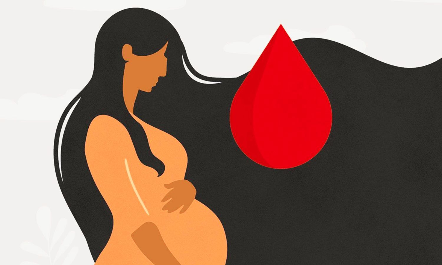 The Unseen Connection of Epidurals and Postpartum Hemorrhage, study finds
