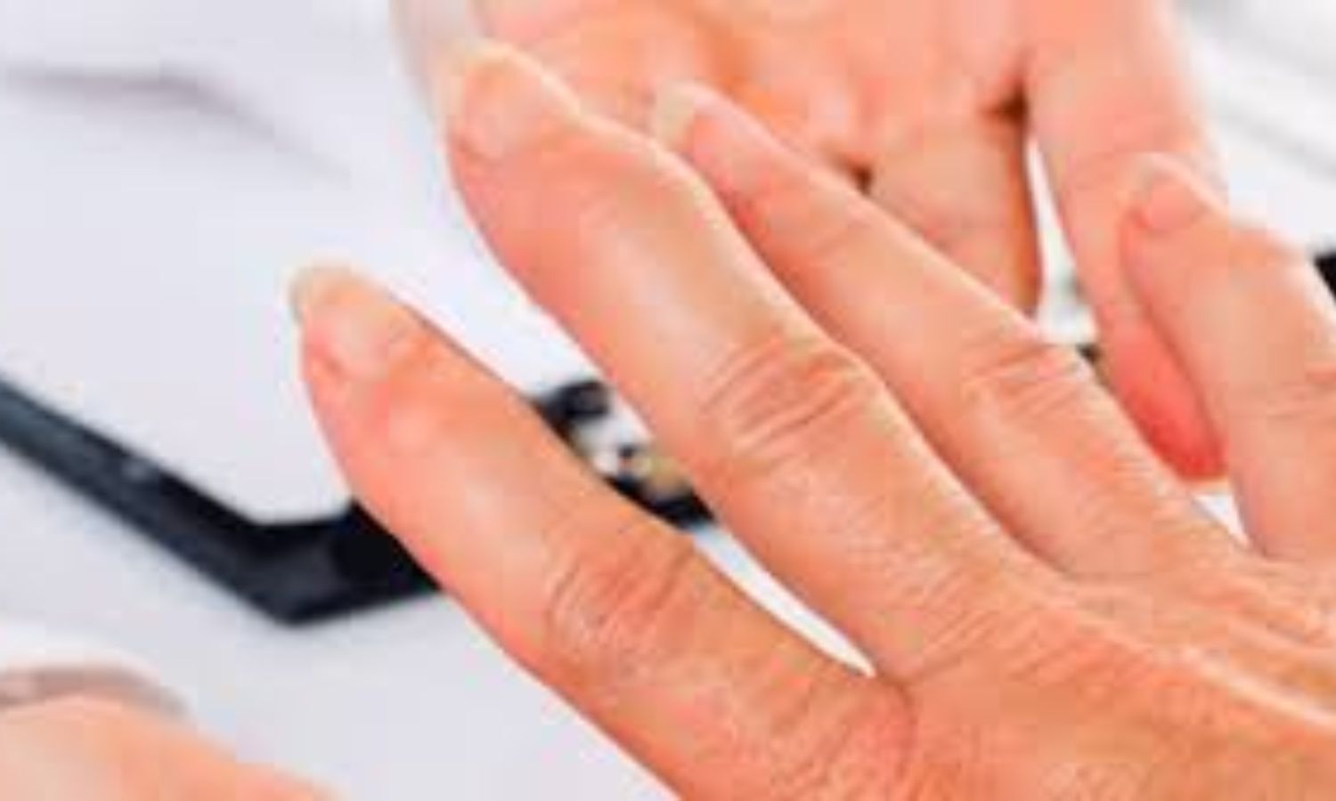 Rheumatoid arthritis linked to increased risk of degenerative valvular heart disease: AHA