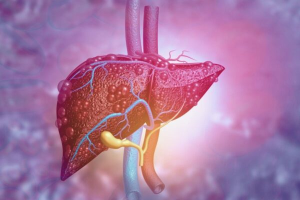 Study Finds GLP-1 RAs May Lower Liver and Heart Complications in MASLD Patients with Diabetes