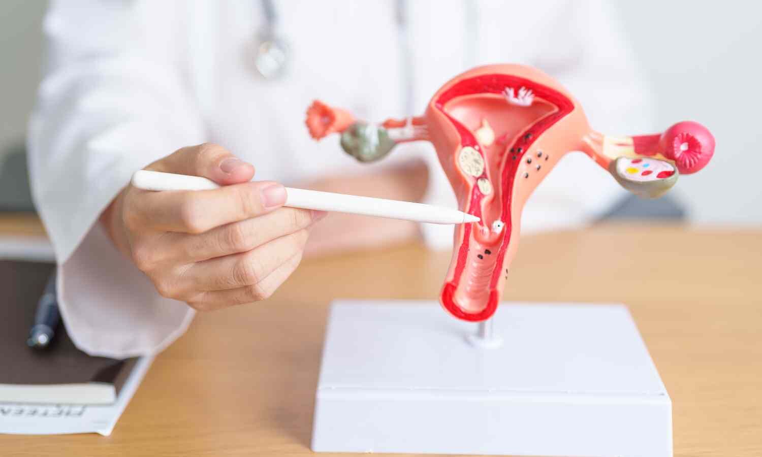 Study explores current state and research innovation in endometrial cancer screening