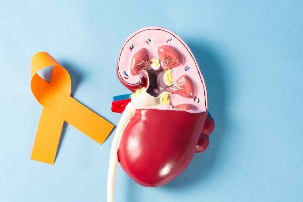 Study reports final clinical trial data for advanced kidney cancer treatment