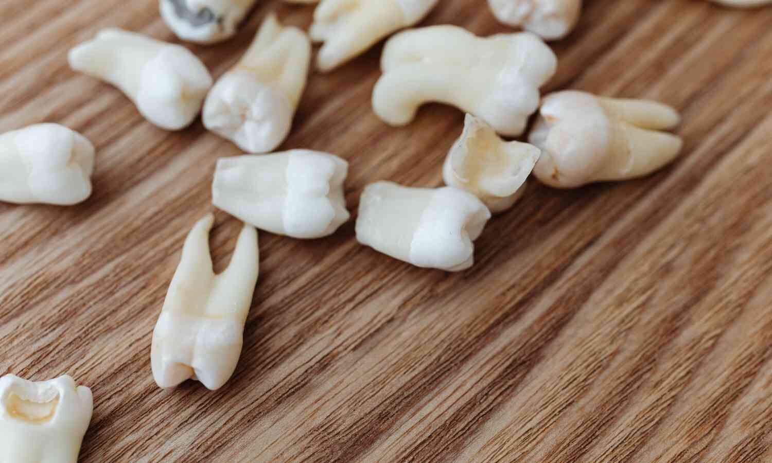 Poor dental health closely associated with the risk of gastric cancer: Study
