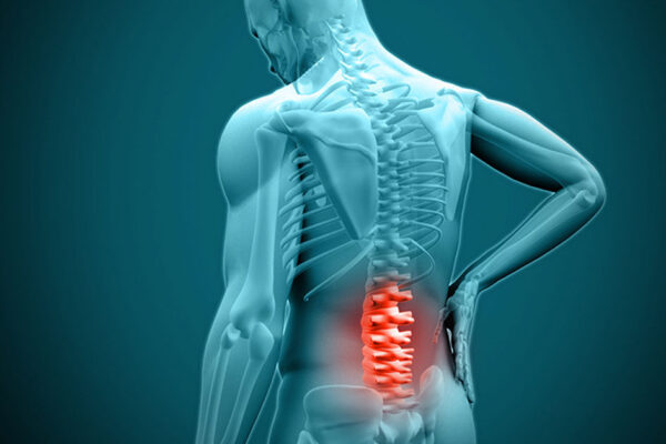 RECK effective opioid-sparing local anesthetic for patients undergoing posterior spinal fusion: study