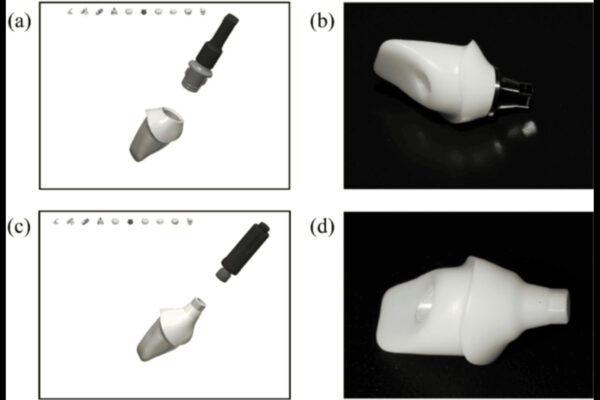 Self-glazed zirconia Abutments Show Superior Fit Over Conventional Zirconia Abutments, finds study