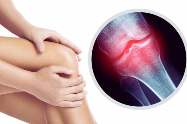 Stopping HRT leads to a period of higher risk of bone fracture for most women: Study