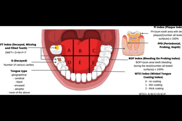 DMFT Score associated with increased risk of Buccal Mucosa Cancer: Study DMFT Score associated with increased risk of Buccal Mucosa Cancer: Study