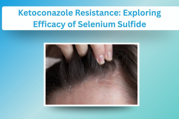Exploring the Efficacy of Selenium Sulfide in Resistant Cases Exploring the Efficacy of Selenium Sulfide in Resistant Cases
