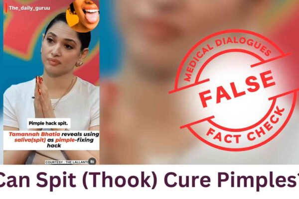 Can Spit (Thook) Cure Pimples?