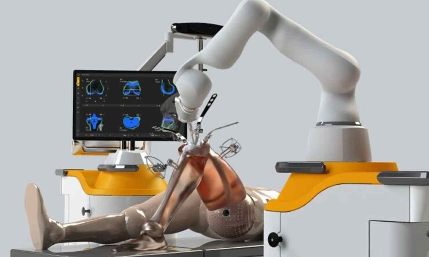Himachal Launches Robotic Surgery at Atal Super Speciality Institute
