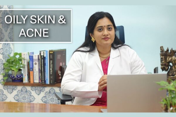 What Causes Oily Skin and Acne? Explained by Dermatologist Dr Shwetha Rahul