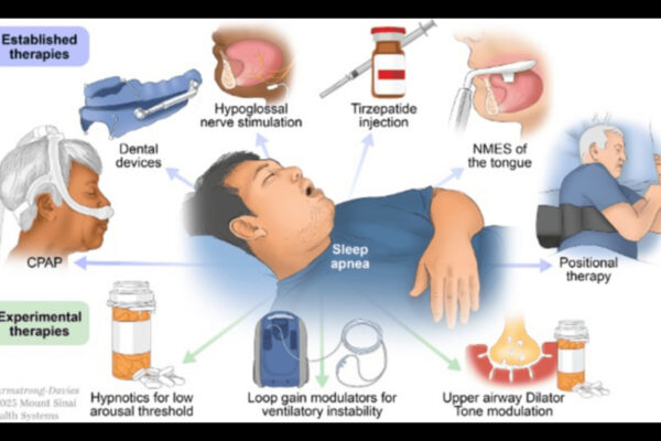Pimavanserin–Atomoxetine Combo Shows Promise in OSA: Study