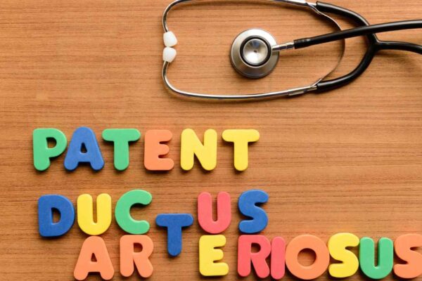 New guidance to improve safety and outcomes of patent ductus arteriosus closure in premature infants, released by SCAI
