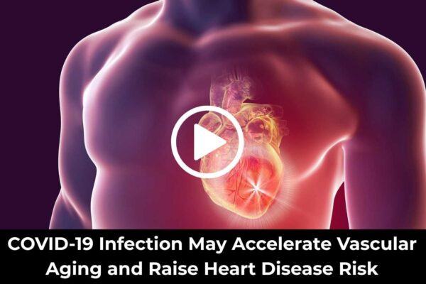 COVID-19 Infection May Accelerate Vascular Aging and Raise Heart Disease Risk: Study Suggests